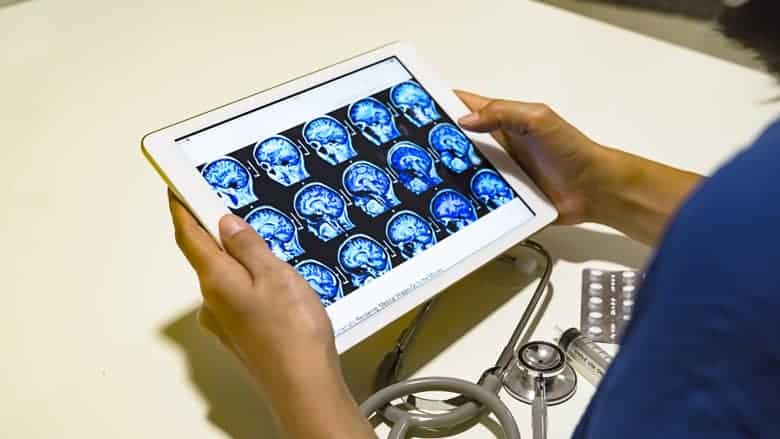 maslinovo ulje dobro je za mozak