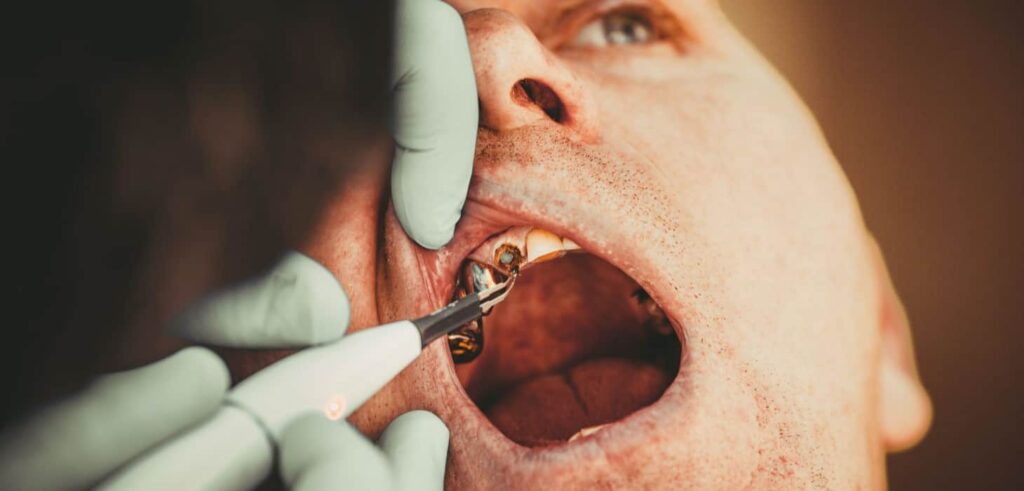 zubna-plomba