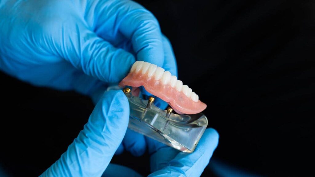 zubna-proteza